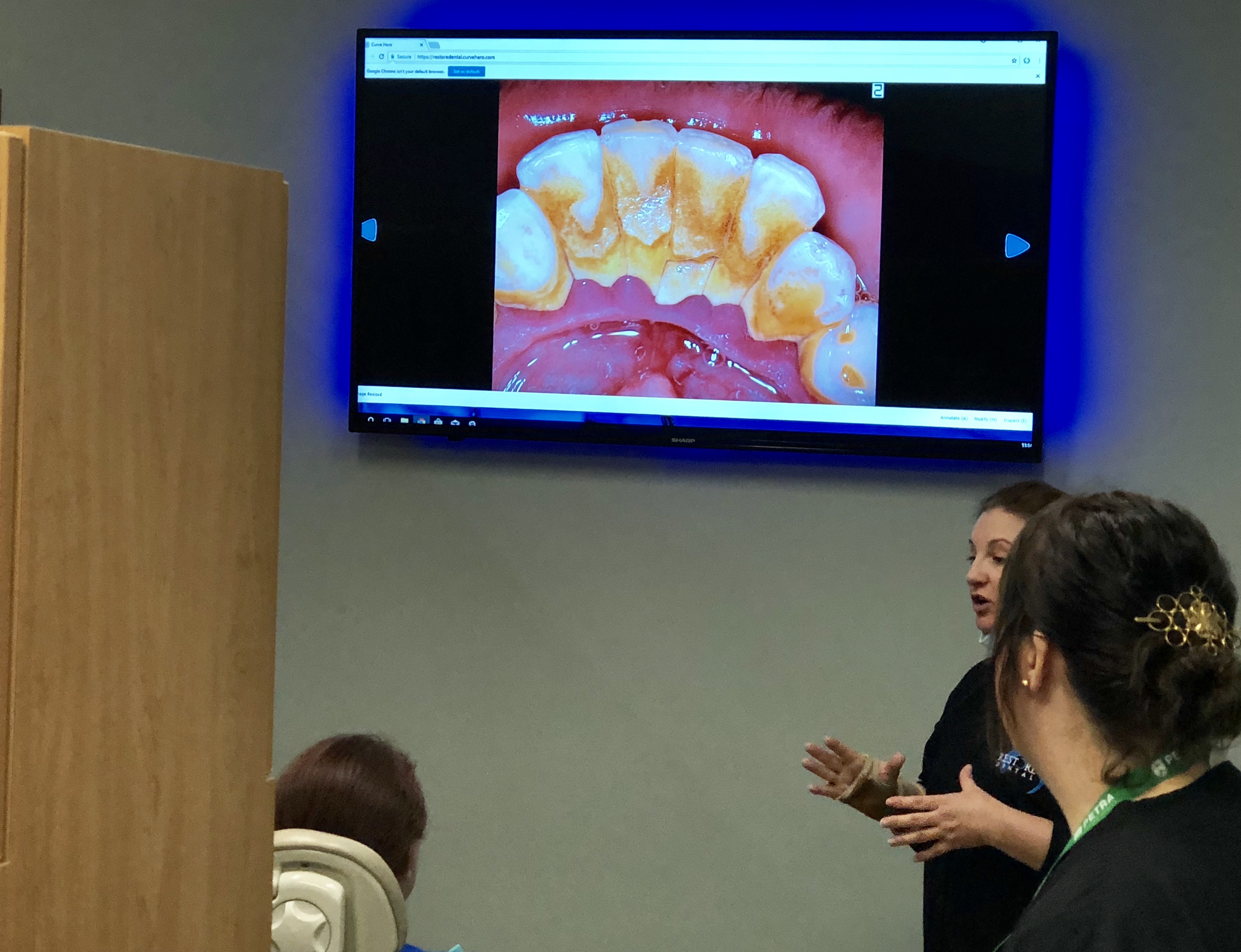 HD intraoral camera