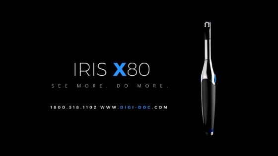 Why an IRIS Intraoral Camera is Your 3rd Eye