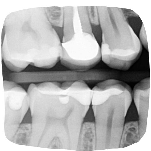 Dental Sensors Digital Doc 1 INTRAORAL CAMERA FOR DENTISTS